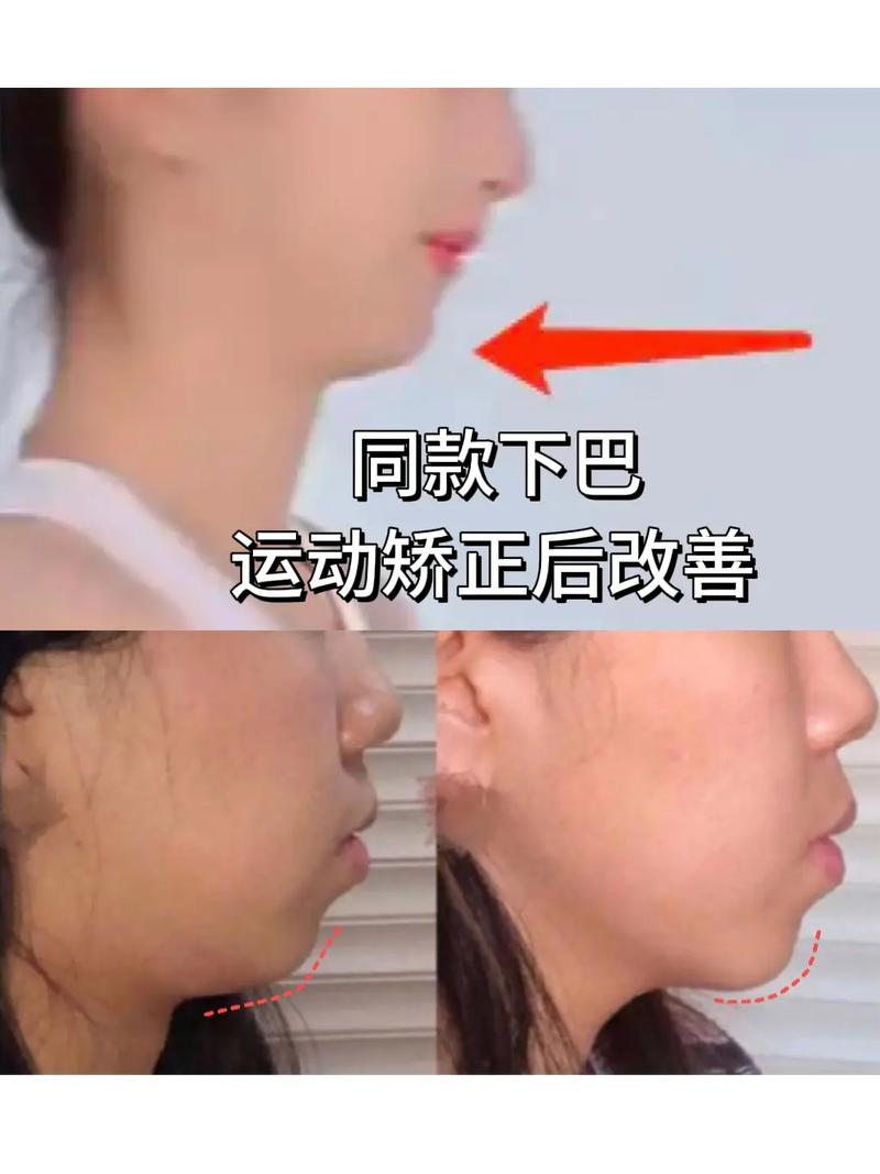 The price of self-empowerment chest surgery