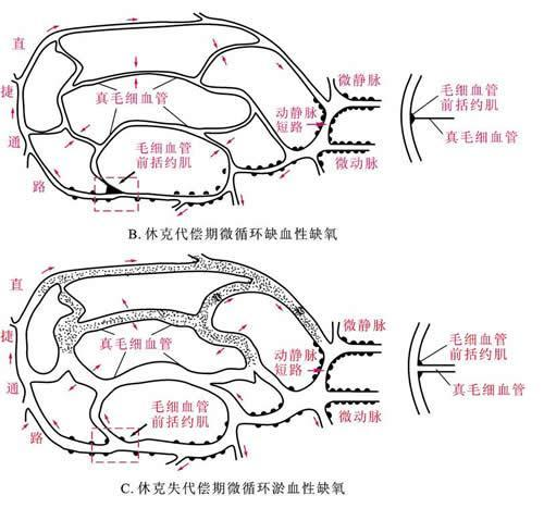休克晚期微循环灌流特点分别是