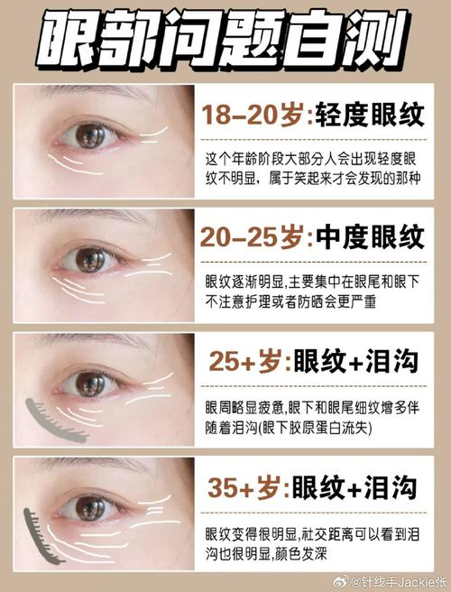 It's a natural way to get a small print right now