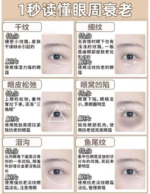 It's a natural way to get a small print right now