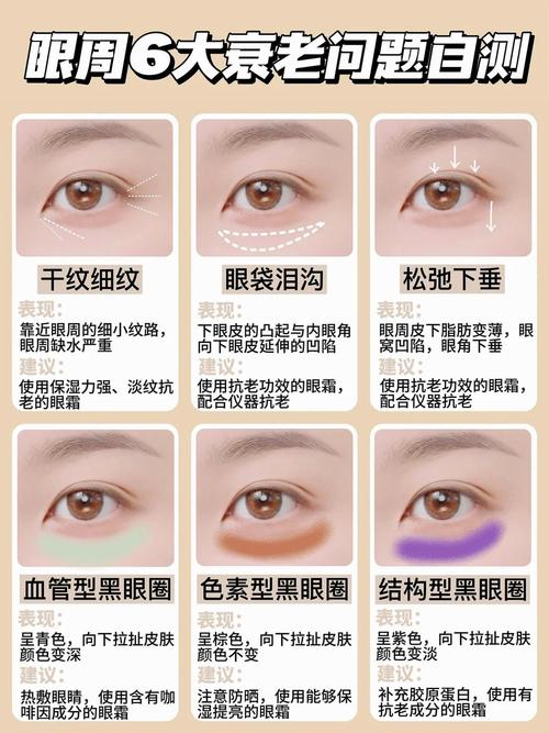 It's a natural way to get a small print right now