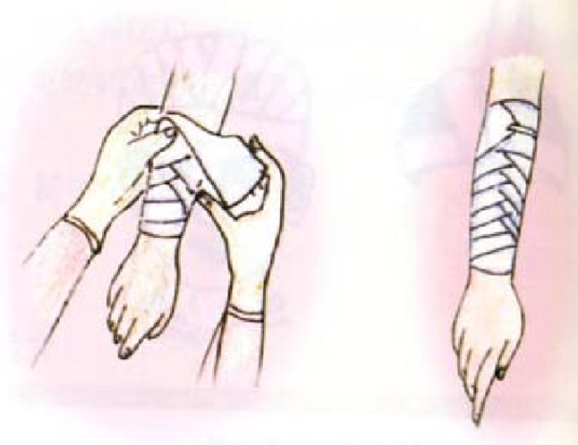 急救知识普及进社区