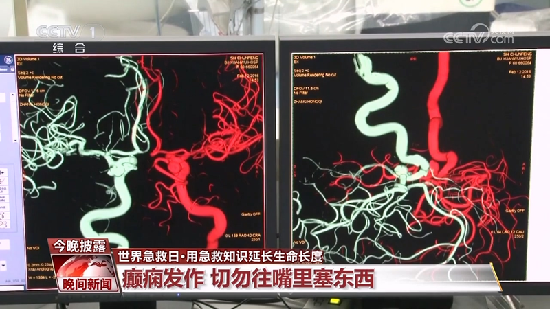 急救知识普及进社区