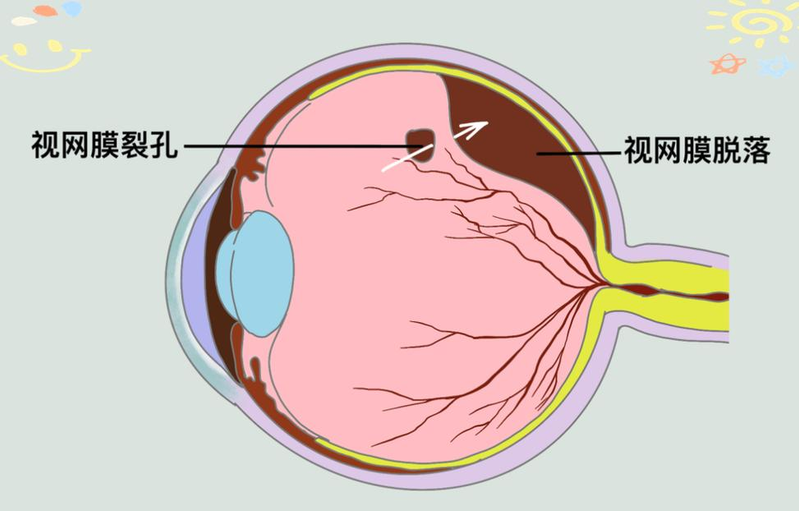 孙慧芳按摩器选购经验分享