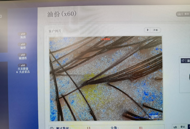 王丽茹;李兴春头发养护与脱发防治160问^^^坐月子常识与新