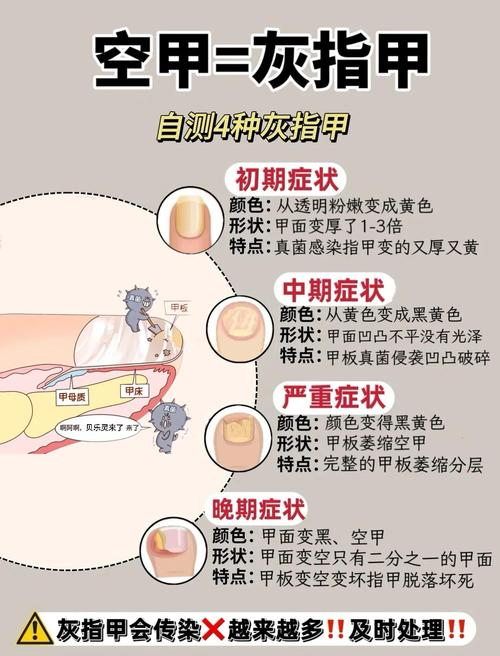 The cause of the gray nails