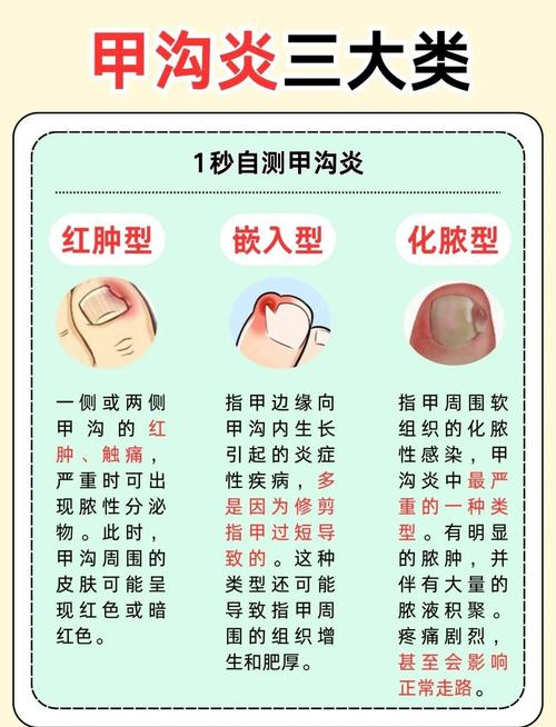 The cause of the gray nails