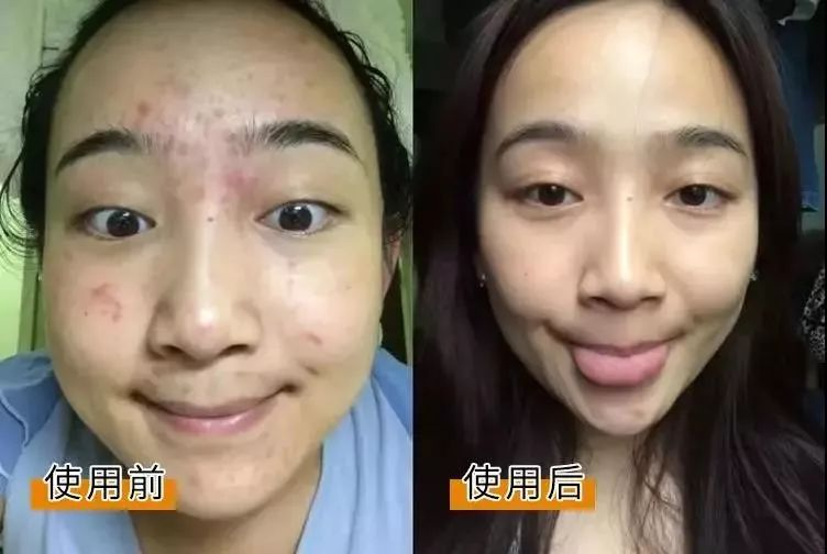 Chinese medicine method