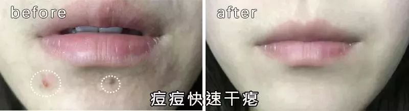 Chinese medicine method