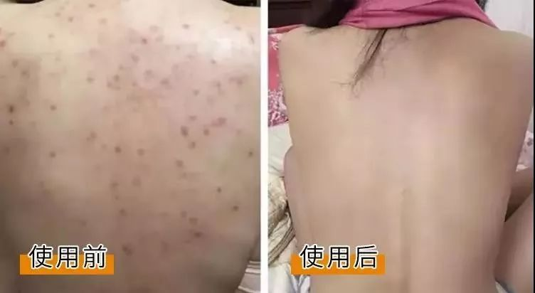 Chinese medicine method