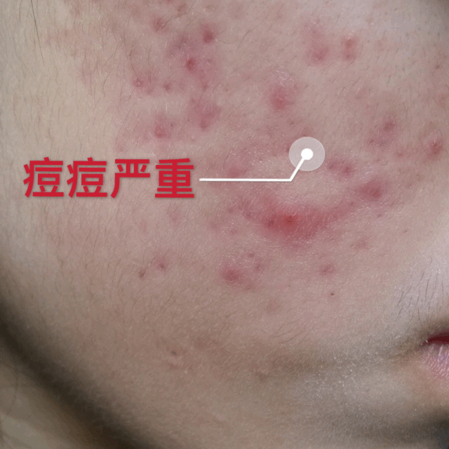 Chinese medicine method