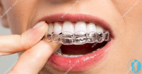 What's the method for the teeth