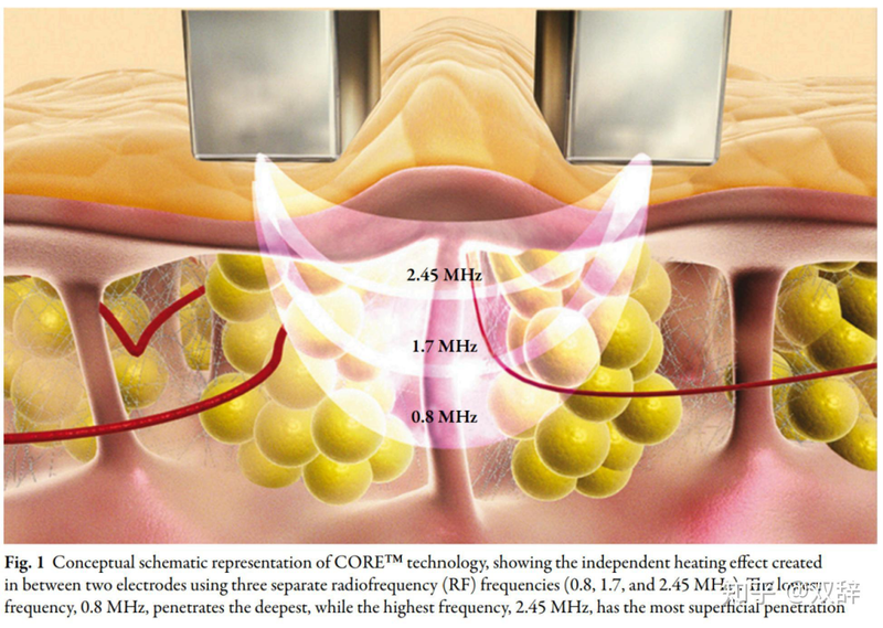 美容整形知识问答