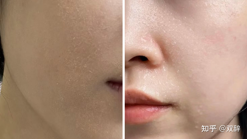 美容整形知识问答