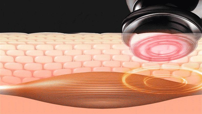 美容整形知识问答