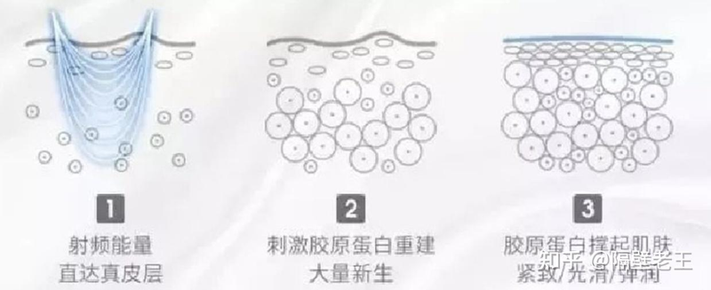 美容整形知识问答