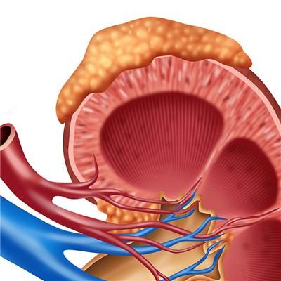 肾肿瘤的血尿特点为