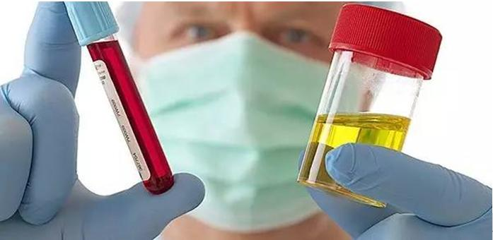 肾肿瘤的血尿特点为