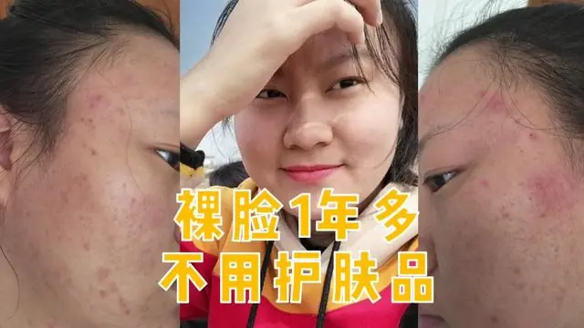 Ten years of skin-care experience