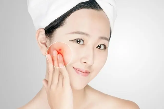 Ten years of skin-care experience