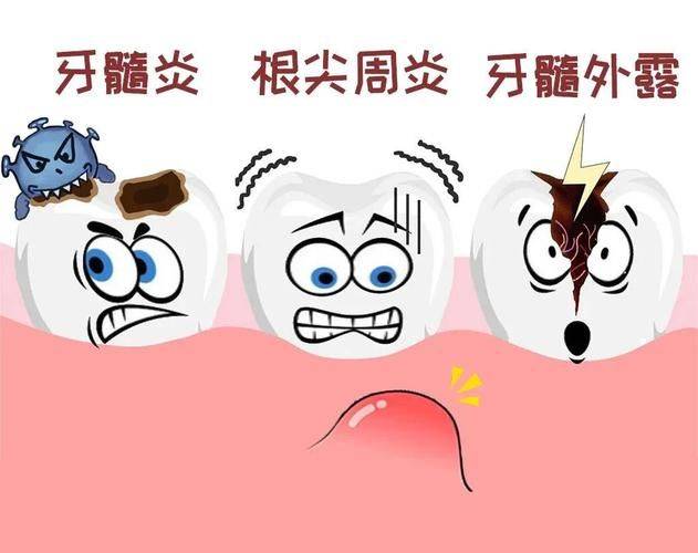 The pain characteristic of acute dental disease