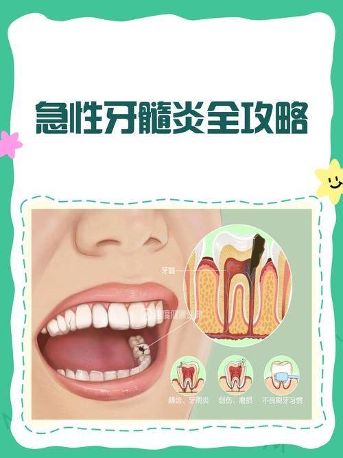 The pain characteristic of acute dental disease