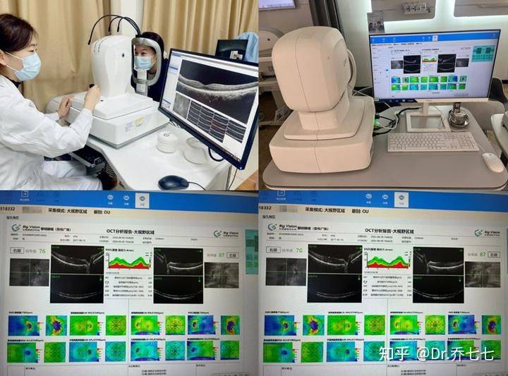 雅诗兰黛 眼霜价格