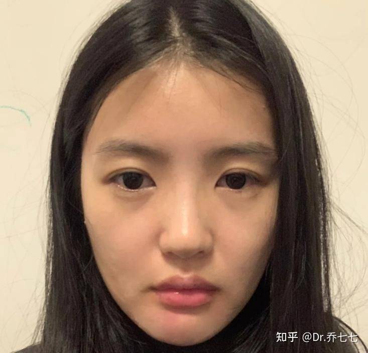 雅诗兰黛 眼霜价格