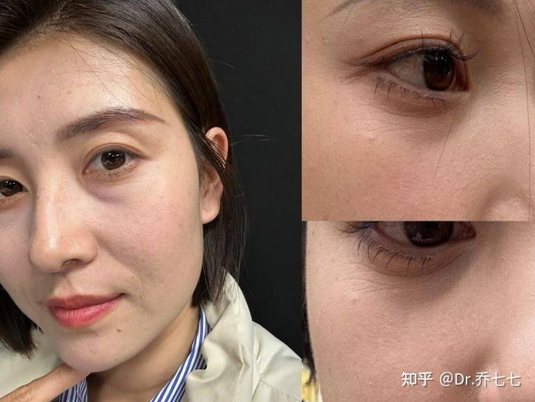 雅诗兰黛 眼霜价格