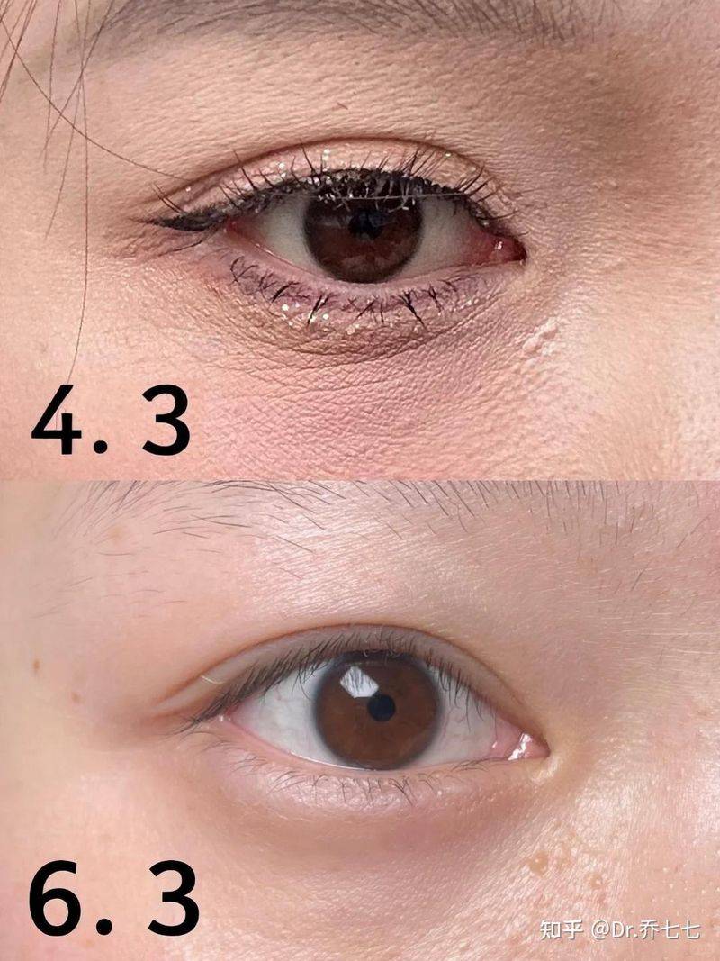 雅诗兰黛 眼霜价格