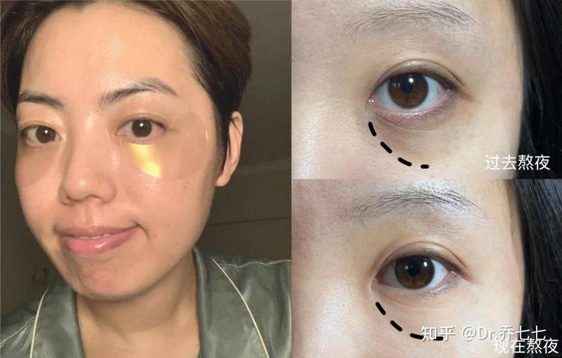 雅诗兰黛 眼霜价格