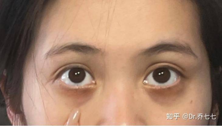 雅诗兰黛 眼霜价格