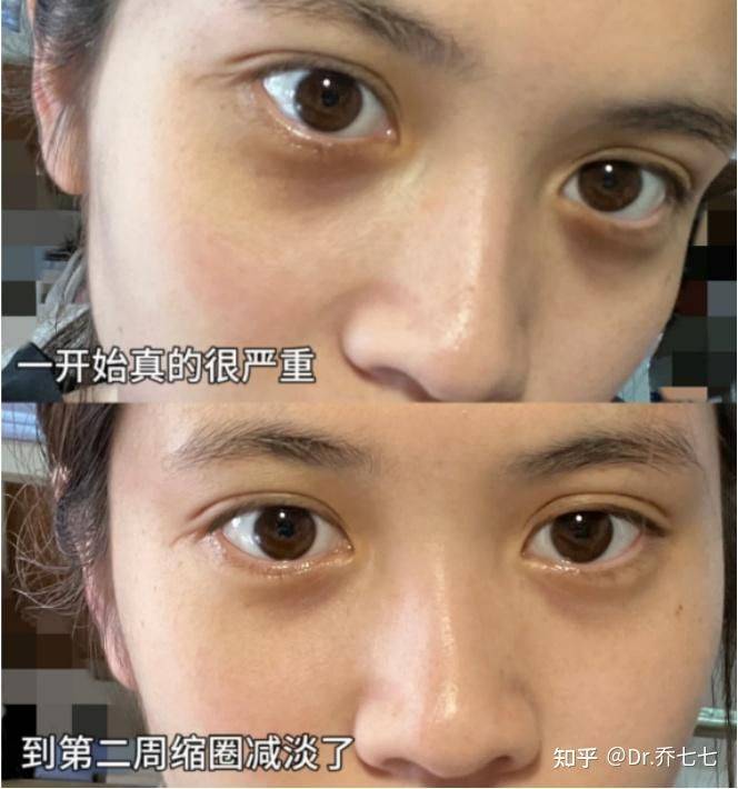 雅诗兰黛 眼霜价格