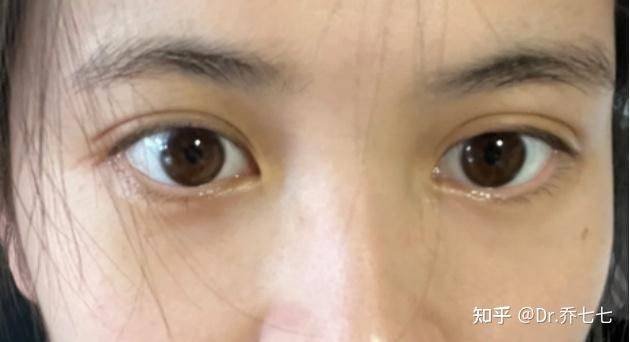 雅诗兰黛 眼霜价格