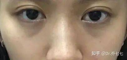 雅诗兰黛 眼霜价格