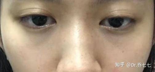 雅诗兰黛 眼霜价格