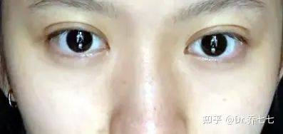 雅诗兰黛 眼霜价格