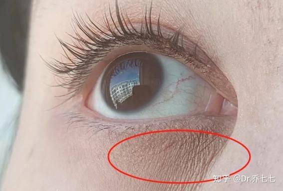 雅诗兰黛 眼霜价格