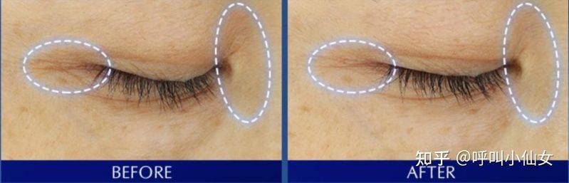 The price of eye cream