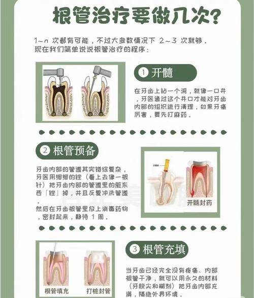 The pain characteristic of acute dental disease