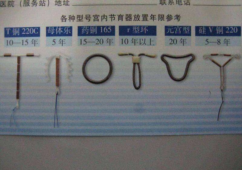 Intrauterine devices, the principles of the ring