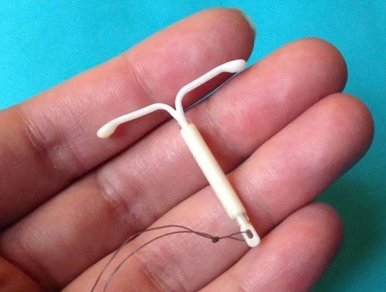 Intrauterine devices, the principles of the ring