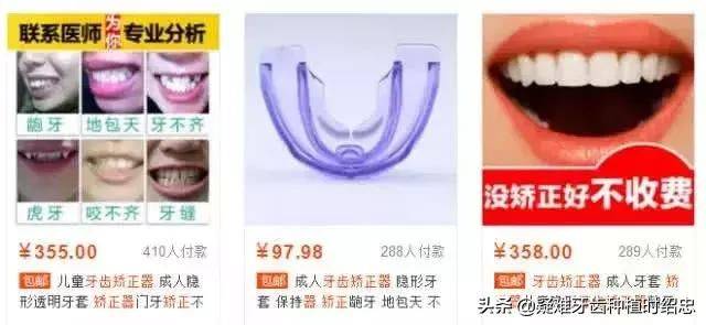 The principle of dental correction