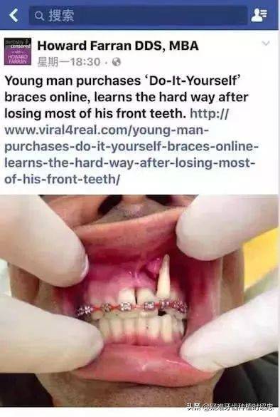 The principle of dental correction