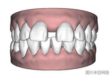The principle of dental correction