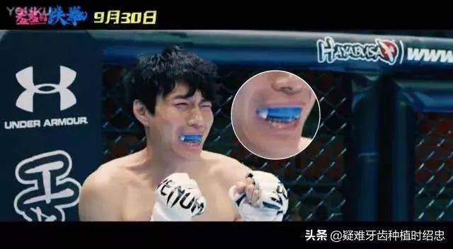 The principle of dental correction