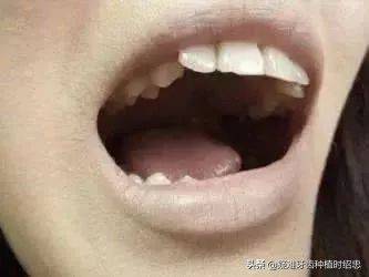 The principle of dental correction