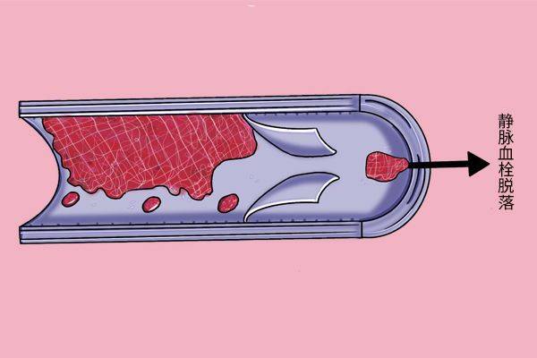 Sugar friend experience sharing