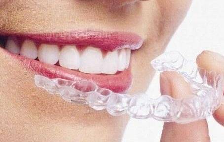 The principle of dental correction