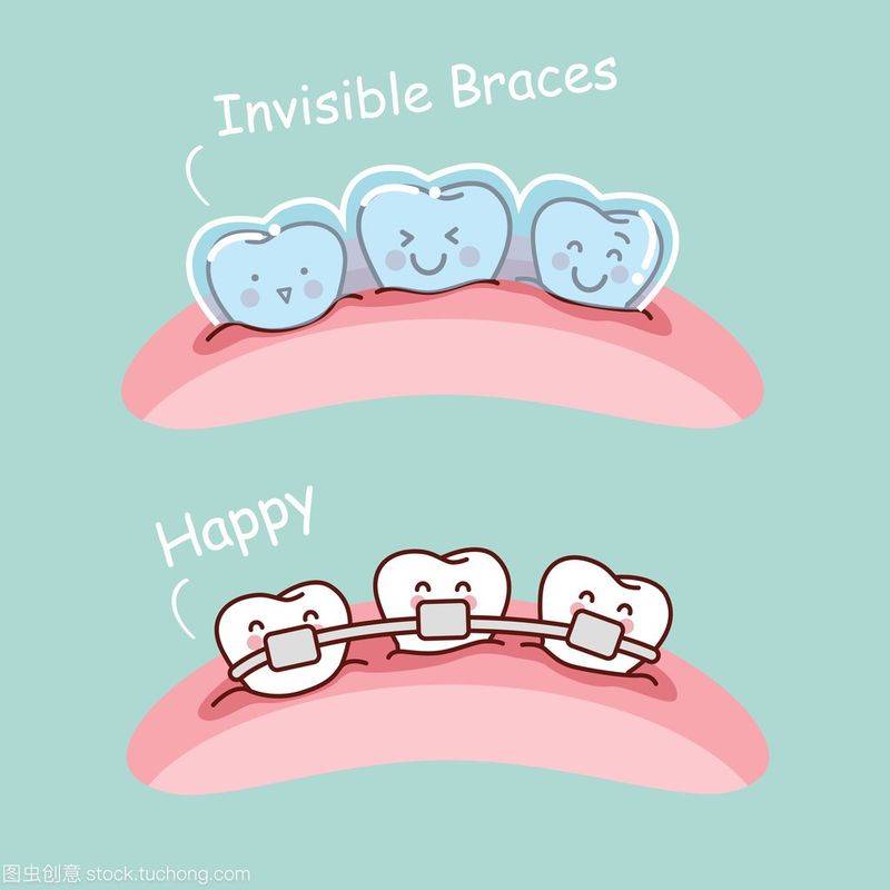 The principle of dental correction